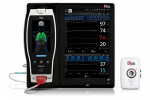 Root Capnography