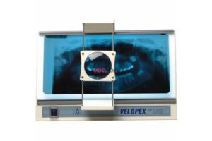Velopex Hi Lite Viewer - стоматологический негатоскоп для интраоральных и панорамных рентгенограмм, с лупой